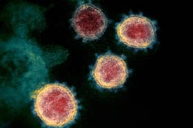 Confirmed cases of Coronavirus continue to rise in Lothian but the number of those being treated in hospital have gone down. (NIAID-RML via AP)