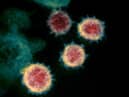 Confirmed cases of Coronavirus continue to rise in Lothian but the number of those being treated in hospital have gone down. (NIAID-RML via AP)