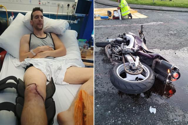 Charlie was only 200 yards from his home when the crash occurred. He suffered several injuries that left him unable to walk. Charlie has been overwhelmed by the support from the biker community that he described as a 'a huge family where there’s a sense of belonging.' He said: "I’ve noticed on the gofundme that there’s a lot of names I don’t recognise, they’re a biker like me and they understand my circumstances and they’re reached out."