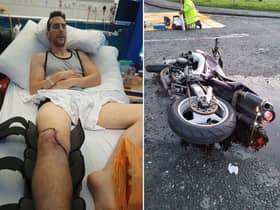 Charlie was only 200 yards from his home when the crash occurred. He suffered several injuries that left him unable to walk. Charlie has been overwhelmed by the support from the biker community that he described as a 'a huge family where there’s a sense of belonging.' He said: "I’ve noticed on the gofundme that there’s a lot of names I don’t recognise, they’re a biker like me and they understand my circumstances and they’re reached out."