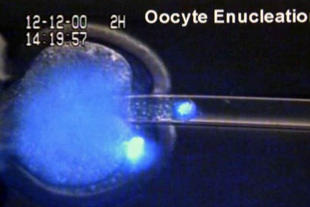 DNA is removed from a mammalian egg. Picture: AP