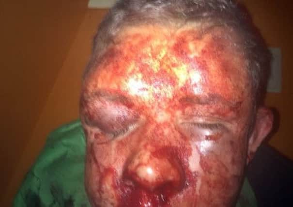 Angus Gallagher was brutally assaulted in Newtongrange