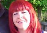 Kirsty Lennon suffered 30 per cent burns. Picture: contributed