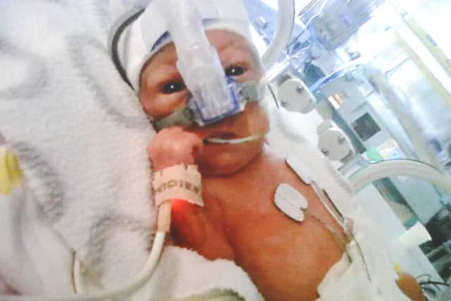 Lily McIntyre was born premature. Picture:Comp