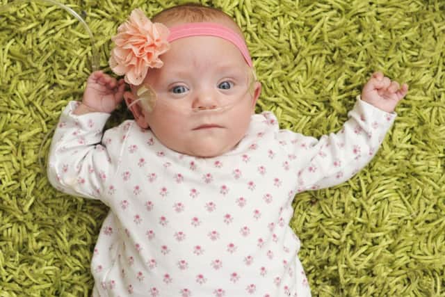 Lily is now 7 months old and home doing well. Picture: Phil Wilkinson