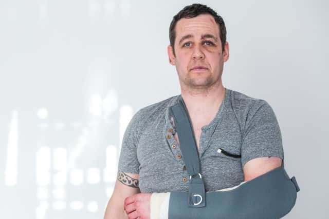 Scott Harrower was badly beaten up in the Cowgate. Picture: Ian Georgeson