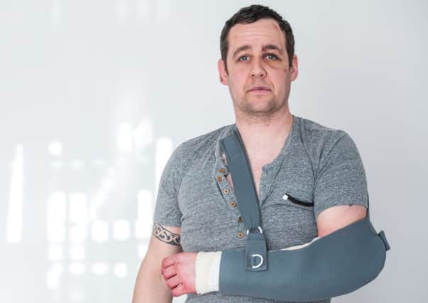 Scott Harrower was badly beaten up in the Cowgate. Picture: Ian Georgeson
