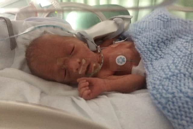 Callum Hoy in an incubator shortly after his birth. Picture: submitted