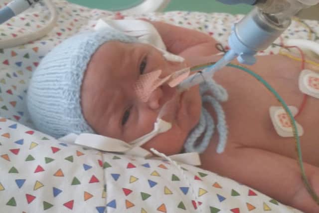 Mackenzie Holgate in hospital, born 10 weeks early