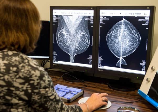 Breast cancer analysis. Picture: Hemedia