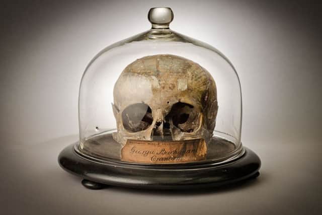 The skull of George Buchanan in a display case at the Anatomical Museum at Edinburgh University. Picture: University of Edinburgh Anatomical Collections/PA Wire