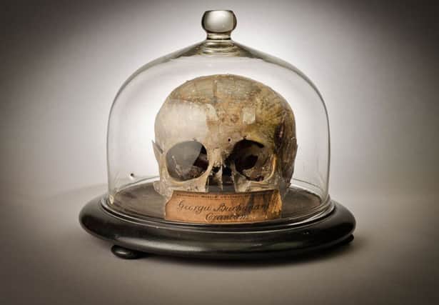 The skull of George Buchanan in a display case at the Anatomical Museum at Edinburgh University. Picture: University of Edinburgh Anatomical Collections/PA Wire
