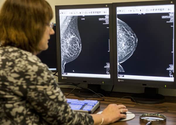 The rise in the incidence of breast cancer is party due to increased screening and detection. Picture: Ian Georgeson