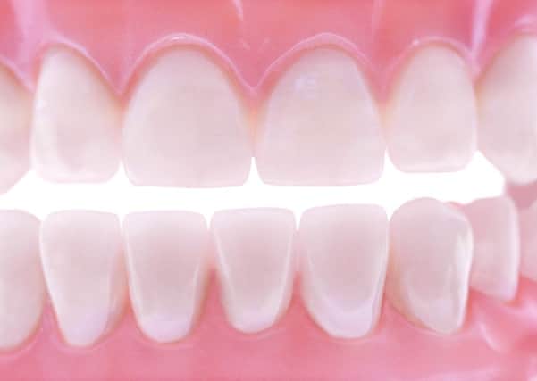 Teeth grinding - do you want to grin and bear it? Photo: PA Photo/thinkstockphotos