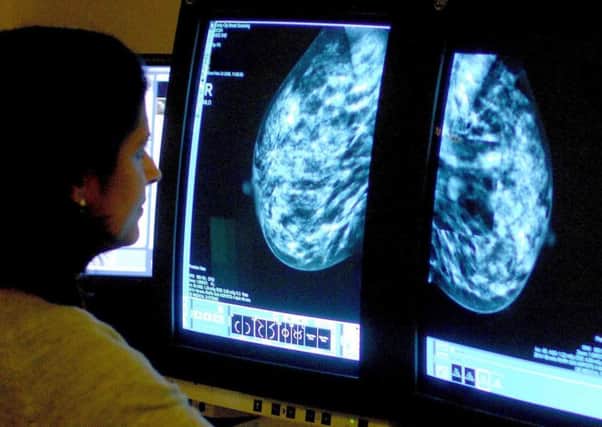 Breast cancer screening saves lives. Picture: PA