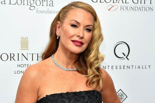 Anastacia is unhappy about the scars on her back. Picture: Matt Crossick/PA Wire