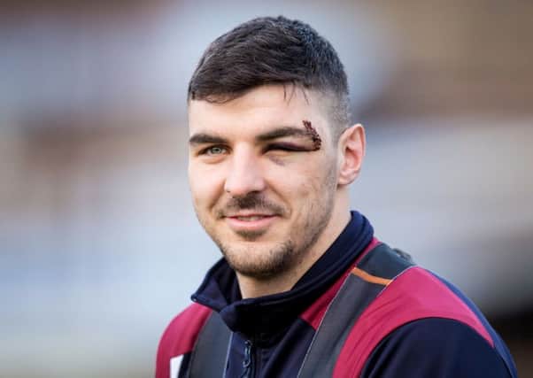 Callum Paterson started for Hearts tonight despite suffering a head injury last weekend