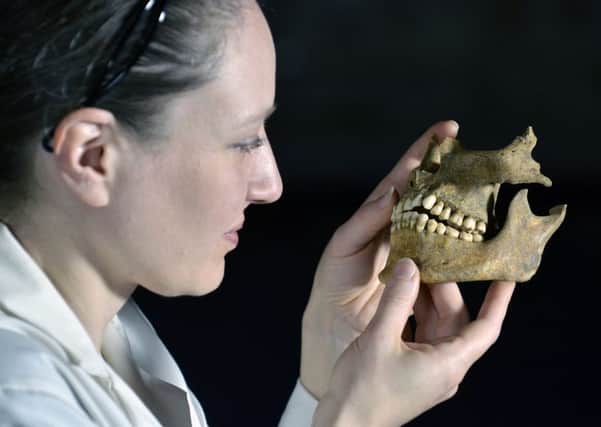 Dr Anwen Caffell of Durham University with remains from the mass grave of Scottish soldiers. PIC North News And Pictures/2daymedia.