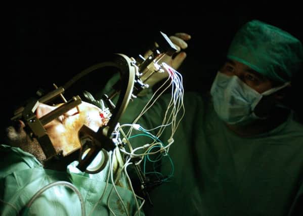 Brain surgeons are warning they are having to cancel operations.