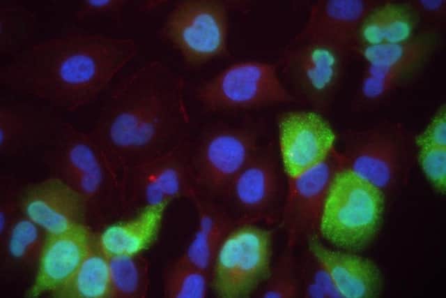 The superbug is immune to our strongest antibiotics. Picture; contributed