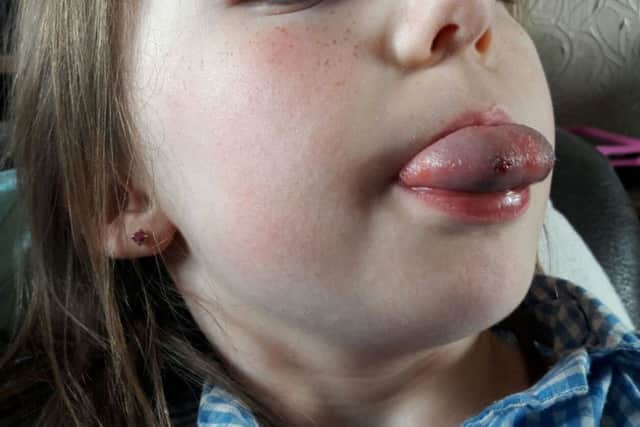 Megan Donald's tongue became jammed in the Monsters Inc screw-top cup while she was at school. Picture: SWNS