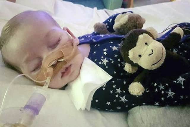 Charlie Gard died weeks befor his 1st birthday.