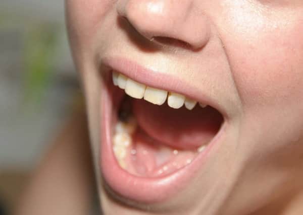 More than 7500 Brits were diagnosed with mouth cancer in the last year