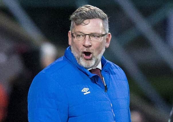 Hearts manager Craig Levein has injury concerns ahead of Wednesday's derby