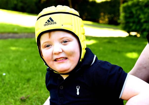 5 year old Murray suffers numerous fits every day. Picture: Lisa Ferguson.