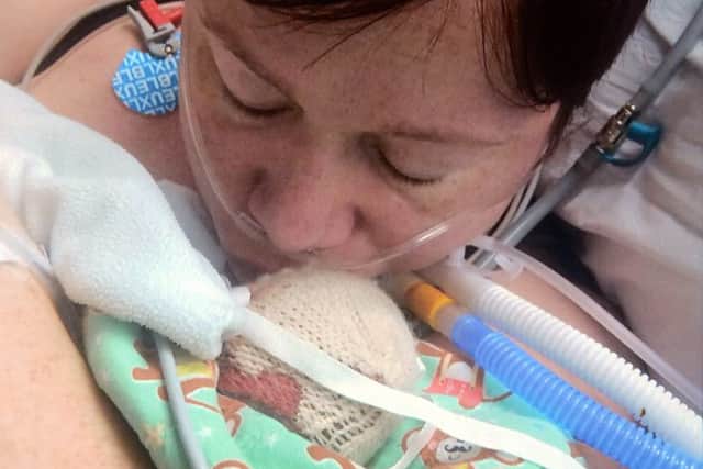 Mum Amy Homes with her son Aiden in hospital. Picture: Jon Savage