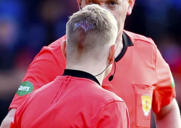 The back of assistant referee Calum Spences head after receiving treatment for a head injury. Picture; SNS