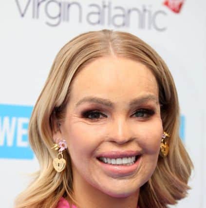 Katie Piper has rebuilt her life since the acid attack in 2008. Picture: JP