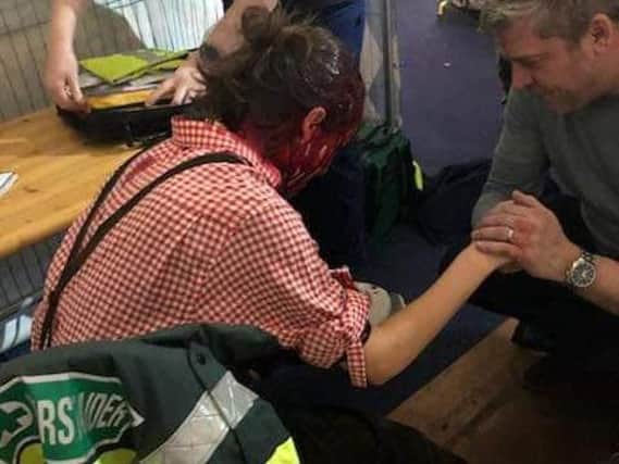 The aftermath of Anna being struck by the beer glass. Pic: Rob Hume Facebook