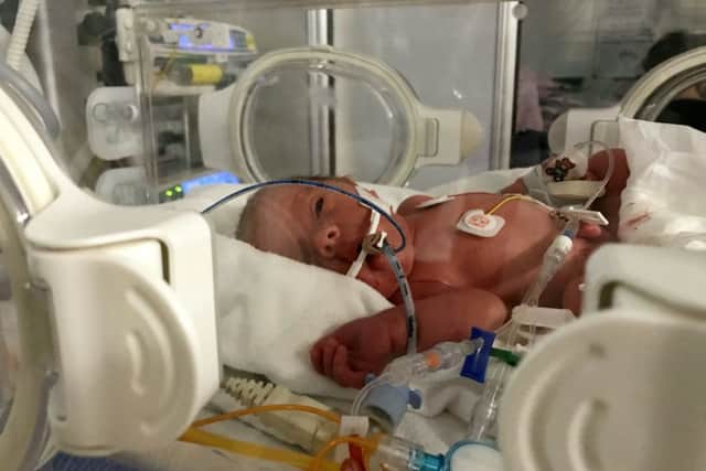 Baby Piper-Koh in Southmead Hospital, Bristol where she was kept in for two months following her birth. Picture: SWNS