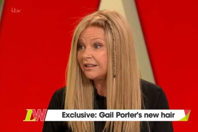Gail Porter said she is ditching her blong wig. Picture: Loose Women/ITV/PA Wire