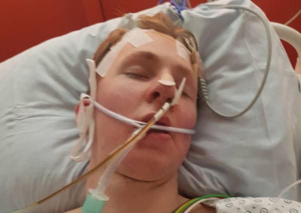 Nicholas was in a coma for almost four days.