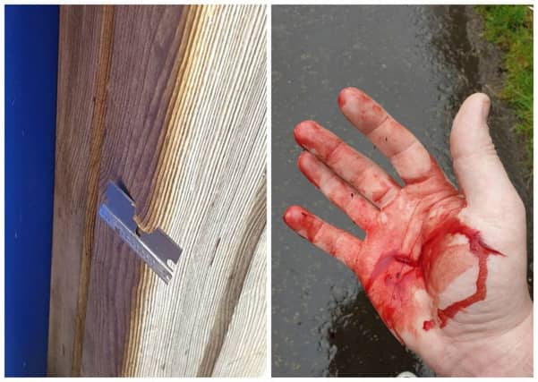 Ross Lambert says he was relieved the razor blade cut him and not a young child. Picture: Contributed