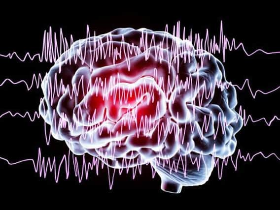 Epilepsy affects around 600,000 people in the UK