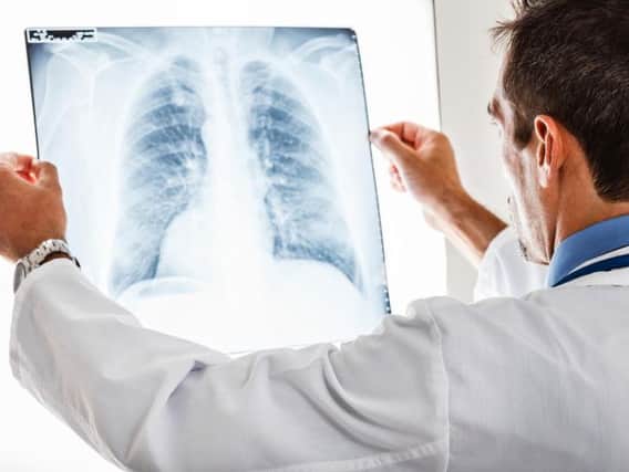 Glasgow sees more cases of tuberculosis than anywhere else in Scotland (Photo: Shutterstock)