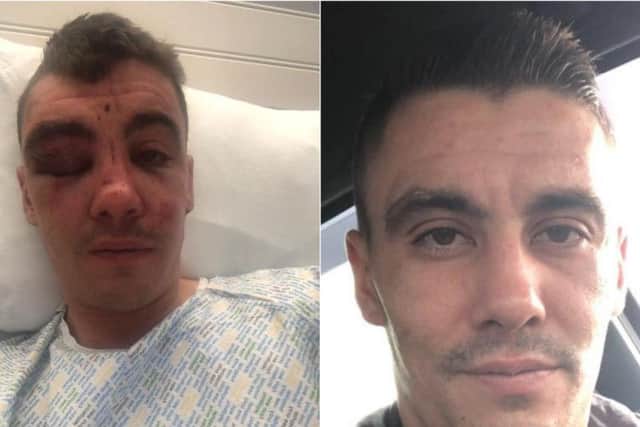 Rhys Reynolds (26) after he was viciously attacked (left) and before the assault