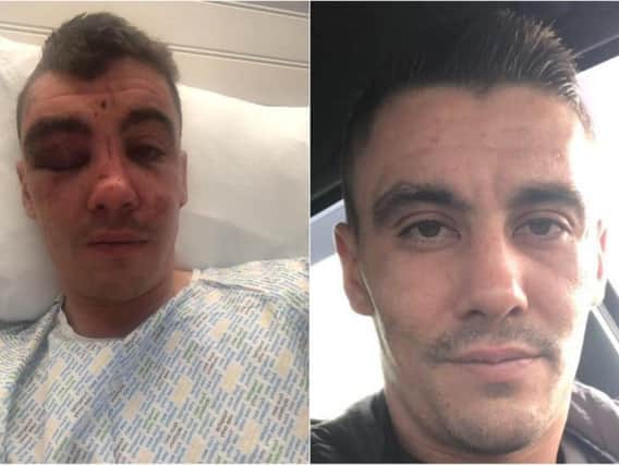 Rhys Reynolds (26) after he was viciously attacked (left) and before the assault