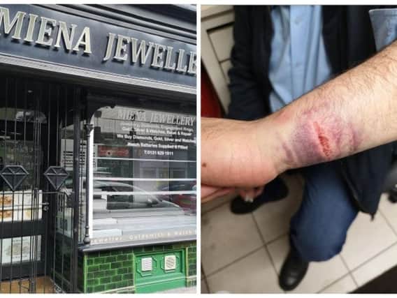 Miena Jewellery was raided on Saturday morning, resulting in the injury to Wail Al-Khamis' arm.