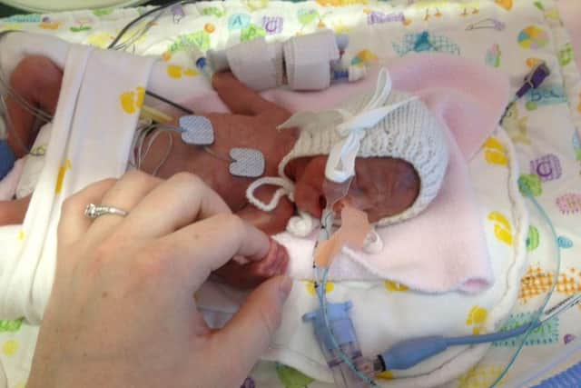 Tiny: Sophie and Bonnie were both very small when they were born 12 weeks premature